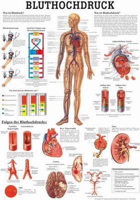Anatomie Poster 2er Set Herzinfarkt & Bluthochdruck